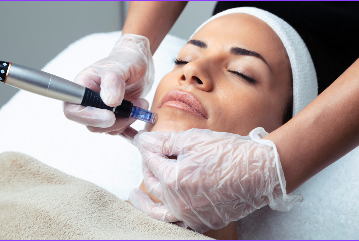 Microneedling for Stretch Marks, Scars, and Body Rejuvenation
